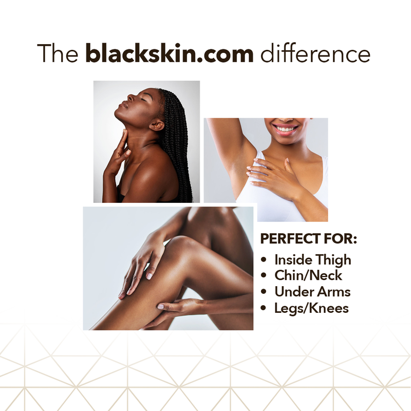 "One product for ingrown hairs and dark spots. Luv it!"