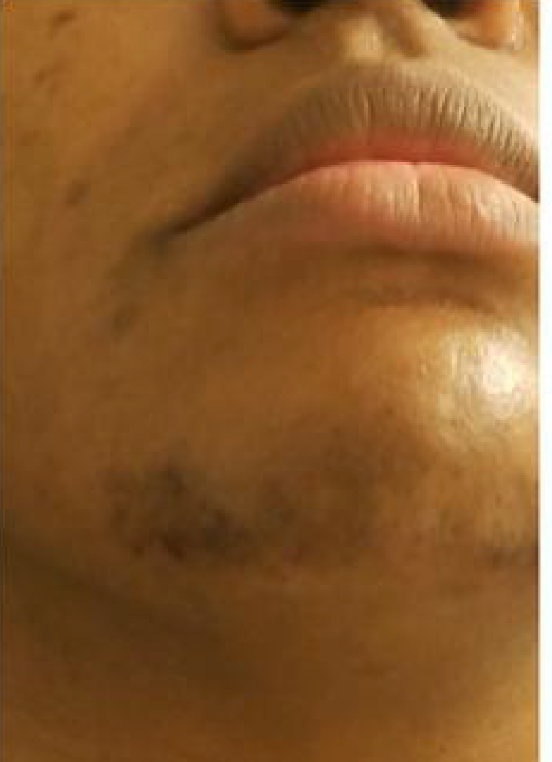 Before Vanessa